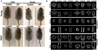 New Surgical Model for Bone–Muscle Injury Reveals Age and Gender-Related Healing Patterns in the 5 Lipoxygenase (5LO) Knockout Mouse